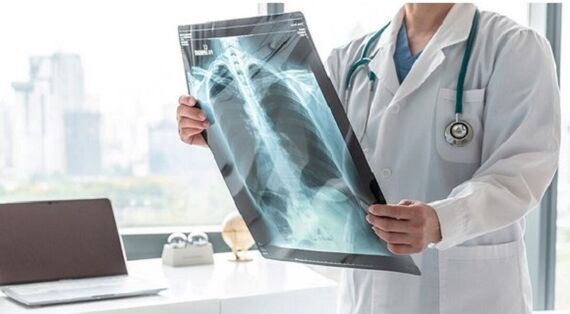Vasaku abaluu all oleva valu röntgendiagnostika