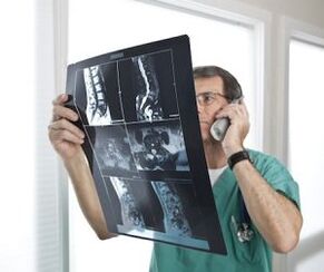 Müelograafia osteokondroosi ja intervertebraalsete hernia diagnoosimiseks